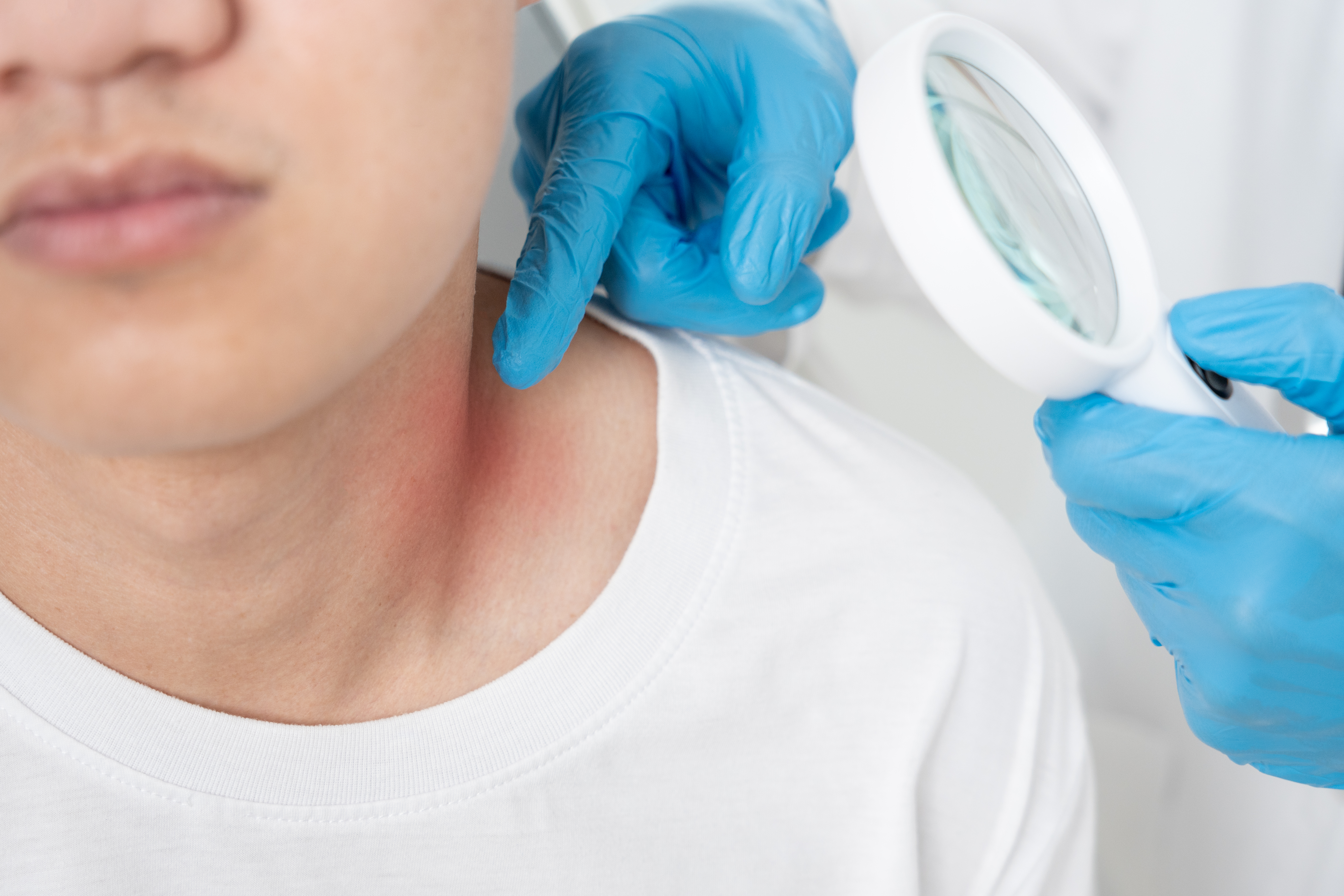 Dermatology